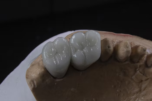 Dentist Implants